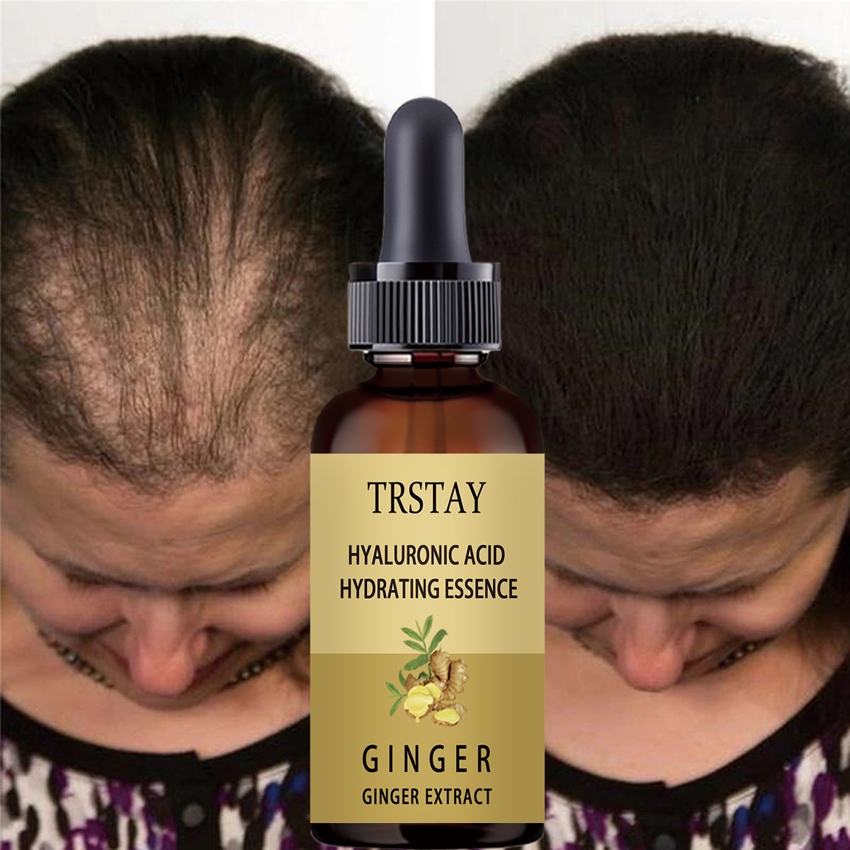 Caffeine Hair Serum - Saç Büyüme Serumu Anti Saç Dökülmesini