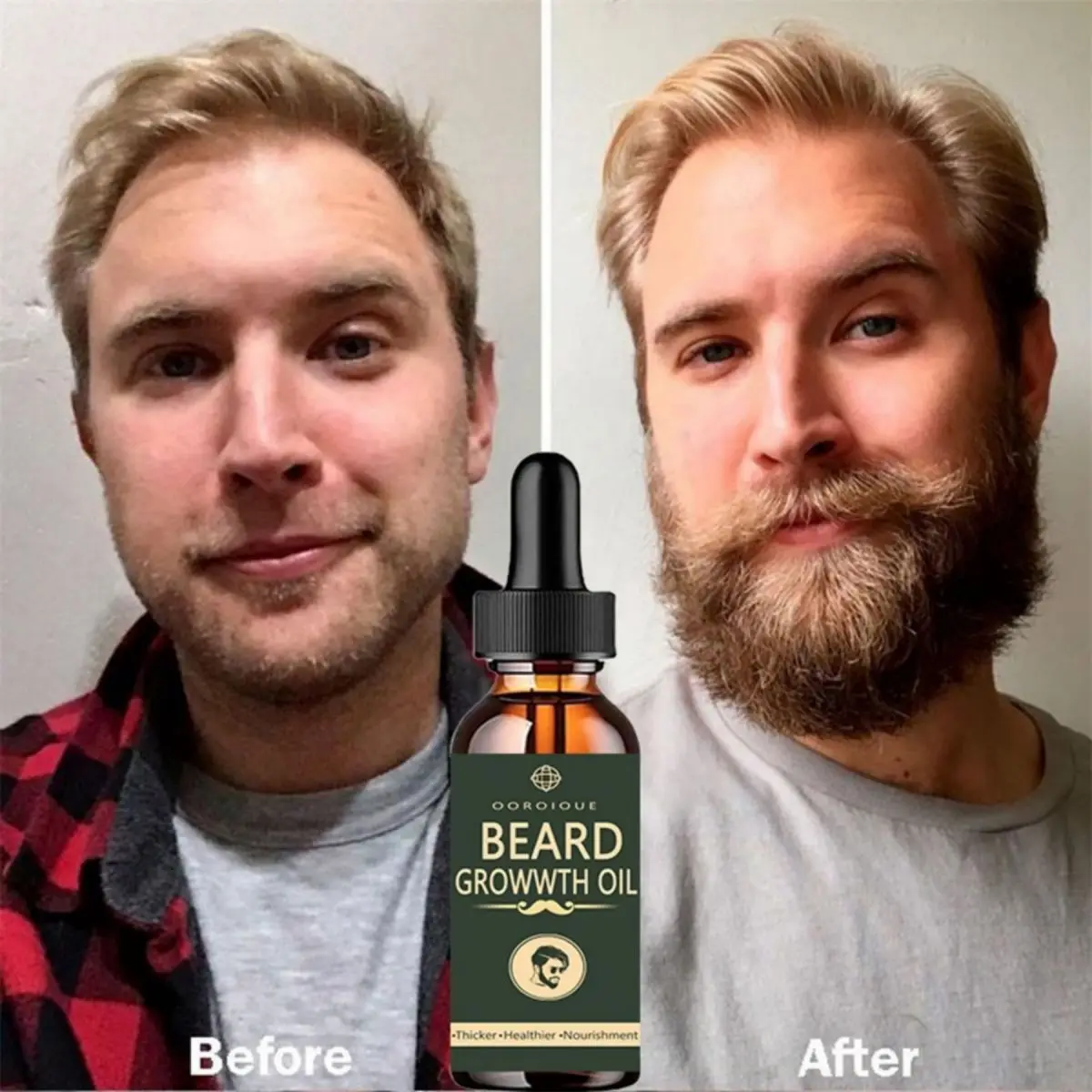 Caffeine Hair Serum - Erkekler için hızlı sakal uzatma yağ