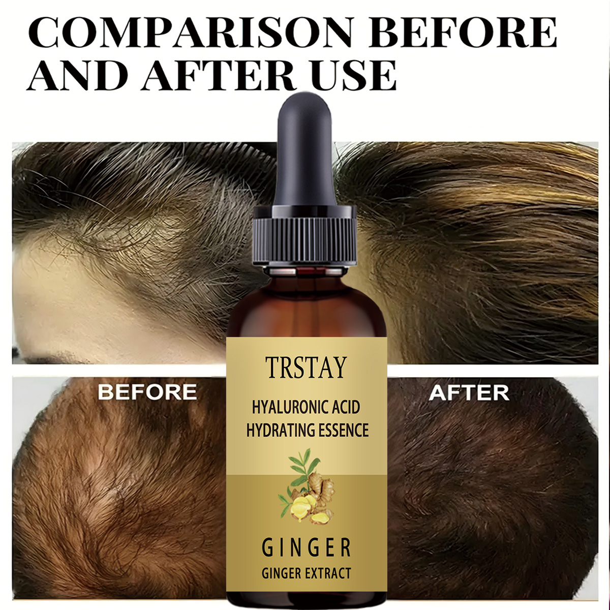 Saç Büyüme Serumu Anti Saç Dök - Caffeine Hair Serum incelemesi ve fiyatı