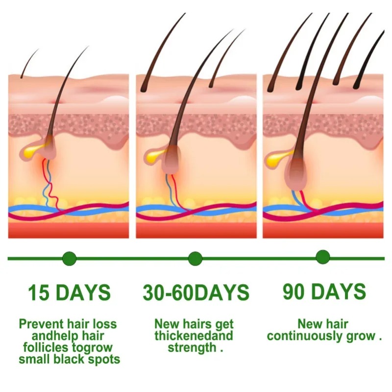 Saç Büyüme Serumu Hızlı Büyüye - Caffeine Hair Serum incelemesi ve fiyatı