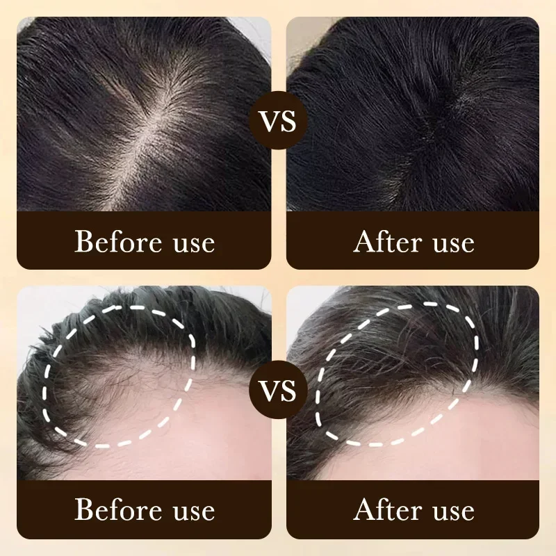Biotin Hızlı Saç Uzatma Yağı Ü - Caffeine Hair Serum incelemesi ve fiyatı