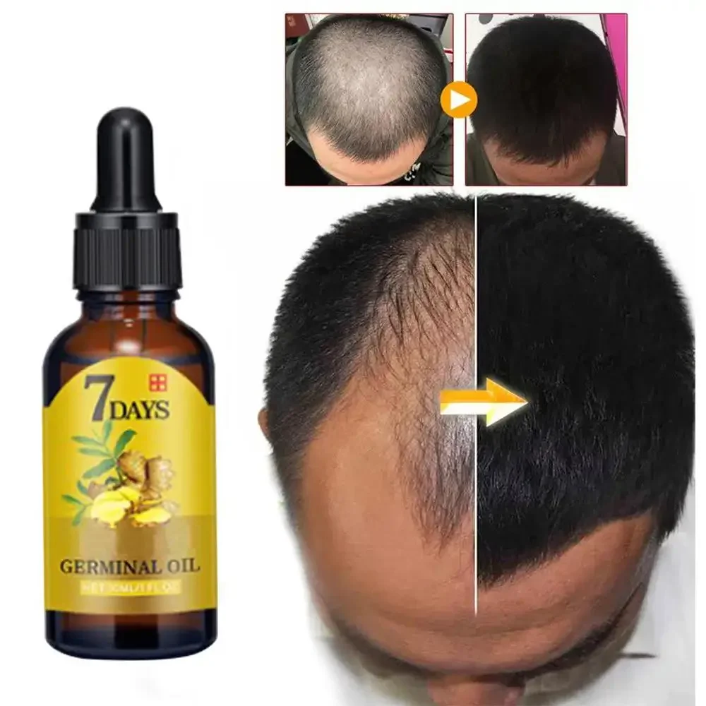 Saç Büyüme Zencefil Hızlı Büyü - Caffeine Hair Serum incelemesi ve fiyatı