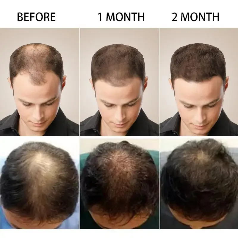Saç Büyüme Zencefil Hızlı Büyü - Caffeine Hair Serum incelemesi ve fiyatı